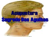 Curso Online de ACUPUNTURA SEGREDO DAS AGULHAS